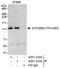 GTF2I Repeat Domain Containing 1 antibody, A301-332A, Bethyl Labs, Immunoprecipitation image 