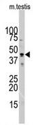 Actin Alpha Cardiac Muscle 1 antibody, AP11505PU-N, Origene, Western Blot image 