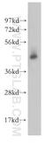 STAM Binding Protein antibody, 11346-1-AP, Proteintech Group, Western Blot image 