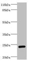 Syntaxin Binding Protein 6 antibody, CSB-PA850881LA01HU, Cusabio, Western Blot image 