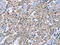 RAB8B, Member RAS Oncogene Family antibody, CSB-PA825683, Cusabio, Immunohistochemistry paraffin image 