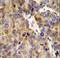 Collagen Type XVIII Alpha 1 Chain antibody, LS-C166919, Lifespan Biosciences, Immunohistochemistry paraffin image 