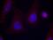 Protein Tyrosine Kinase 2 Beta antibody, GTX50713, GeneTex, Immunofluorescence image 