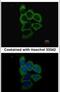 Proteasome 26S Subunit, Non-ATPase 2 antibody, PA5-27663, Invitrogen Antibodies, Immunofluorescence image 