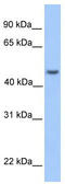 Ankyrin Repeat And SOCS Box Containing 6 antibody, TA337569, Origene, Western Blot image 