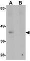 NK2 Homeobox 2 antibody, GTX31470, GeneTex, Western Blot image 