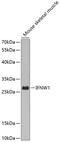 Interferon Omega 1 antibody, GTX66025, GeneTex, Western Blot image 