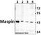 Serpin Family B Member 5 antibody, GTX66666, GeneTex, Western Blot image 