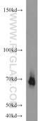 Adrenoceptor Alpha 1B antibody, 22419-1-AP, Proteintech Group, Western Blot image 