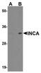 Inhibitor Of CDK, Cyclin A1 Interacting Protein 1 antibody, orb75329, Biorbyt, Western Blot image 