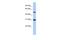 Peptidase Inhibitor 16 antibody, A09887, Boster Biological Technology, Western Blot image 