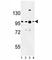 BAF Chromatin Remodeling Complex Subunit BCL11A antibody, F51825-0.4ML, NSJ Bioreagents, Western Blot image 