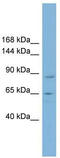 TBC1 Domain Containing Kinase antibody, TA339174, Origene, Western Blot image 