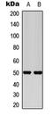 Secretin Receptor antibody, LS-C368510, Lifespan Biosciences, Western Blot image 
