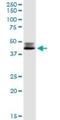 Dihydrolipoamide S-Succinyltransferase antibody, H00001743-D01P, Novus Biologicals, Western Blot image 