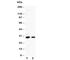 Granzyme B antibody, R30828, NSJ Bioreagents, Western Blot image 