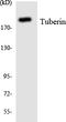 TSC Complex Subunit 2 antibody, LS-C292222, Lifespan Biosciences, Western Blot image 