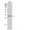 Cyclin Dependent Kinase Inhibitor 1C antibody, LS-C385318, Lifespan Biosciences, Western Blot image 