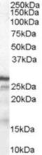 Cyclin Dependent Kinase Inhibitor 1B antibody, LS-C34624, Lifespan Biosciences, Western Blot image 