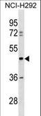 TUB Like Protein 3 antibody, LS-C157299, Lifespan Biosciences, Western Blot image 