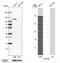 Inositol Polyphosphate-4-Phosphatase Type II B antibody, NBP1-85883, Novus Biologicals, Western Blot image 
