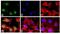 Signal Transducer And Activator Of Transcription 5A antibody, 44-390G, Invitrogen Antibodies, Immunofluorescence image 