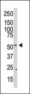 Phosphatidylinositol 4-Kinase Type 2 Beta antibody, MBS9214413, MyBioSource, Western Blot image 