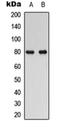 RAD17 Checkpoint Clamp Loader Component antibody, orb304539, Biorbyt, Western Blot image 