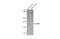 ATP Binding Cassette Subfamily B Member 11 antibody, GTX102608, GeneTex, Western Blot image 