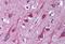 Presenilin 1 antibody, MBS241306, MyBioSource, Immunohistochemistry paraffin image 
