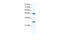 DExD-Box Helicase 39B antibody, 28-485, ProSci, Western Blot image 