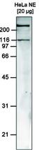 SWI/SNF Related, Matrix Associated, Actin Dependent Regulator Of Chromatin, Subfamily A, Member 5 antibody, MA5-23508, Invitrogen Antibodies, Western Blot image 