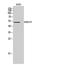 RAB3A Interacting Protein antibody, A09085, Boster Biological Technology, Western Blot image 