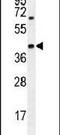 Alpha-Methylacyl-CoA Racemase antibody, PA5-23619, Invitrogen Antibodies, Western Blot image 