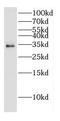 CNOT7 antibody, FNab01811, FineTest, Western Blot image 