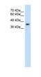 GNAS complex locus  antibody, orb330253, Biorbyt, Western Blot image 