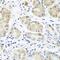 Centrosomin antibody, GTX32578, GeneTex, Immunohistochemistry paraffin image 