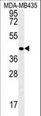 Vasohibin 2 antibody, LS-C160500, Lifespan Biosciences, Western Blot image 