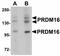 PR/SET Domain 16 antibody, orb89852, Biorbyt, Western Blot image 