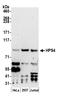 HPS4 Biogenesis Of Lysosomal Organelles Complex 3 Subunit 2 antibody, A305-513A, Bethyl Labs, Western Blot image 