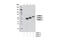 Calcium/Calmodulin Dependent Protein Kinase II Beta antibody, 4436S, Cell Signaling Technology, Western Blot image 