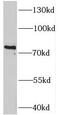 TGF-Beta Activated Kinase 1 (MAP3K7) Binding Protein 2 antibody, FNab08465, FineTest, Western Blot image 