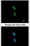 Zinc Finger C3HC-Type Containing 1 antibody, PA5-29367, Invitrogen Antibodies, Immunofluorescence image 