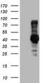 Nuclear Receptor Subfamily 3 Group C Member 1 antibody, LS-C339876, Lifespan Biosciences, Western Blot image 