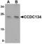 Coiled-Coil Domain Containing 134 antibody, MBS150943, MyBioSource, Western Blot image 