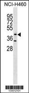 Glycosyltransferase 8 Domain Containing 1 antibody, 59-816, ProSci, Western Blot image 