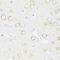 Caspase 8 antibody, 13-984, ProSci, Immunohistochemistry paraffin image 