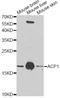 Acid Phosphatase 1 antibody, STJ22489, St John