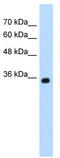 Zinc Finger MYND-Type Containing 11 antibody, TA337299, Origene, Western Blot image 