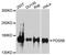 PDS5 Cohesin Associated Factor B antibody, A9357, ABclonal Technology, Western Blot image 